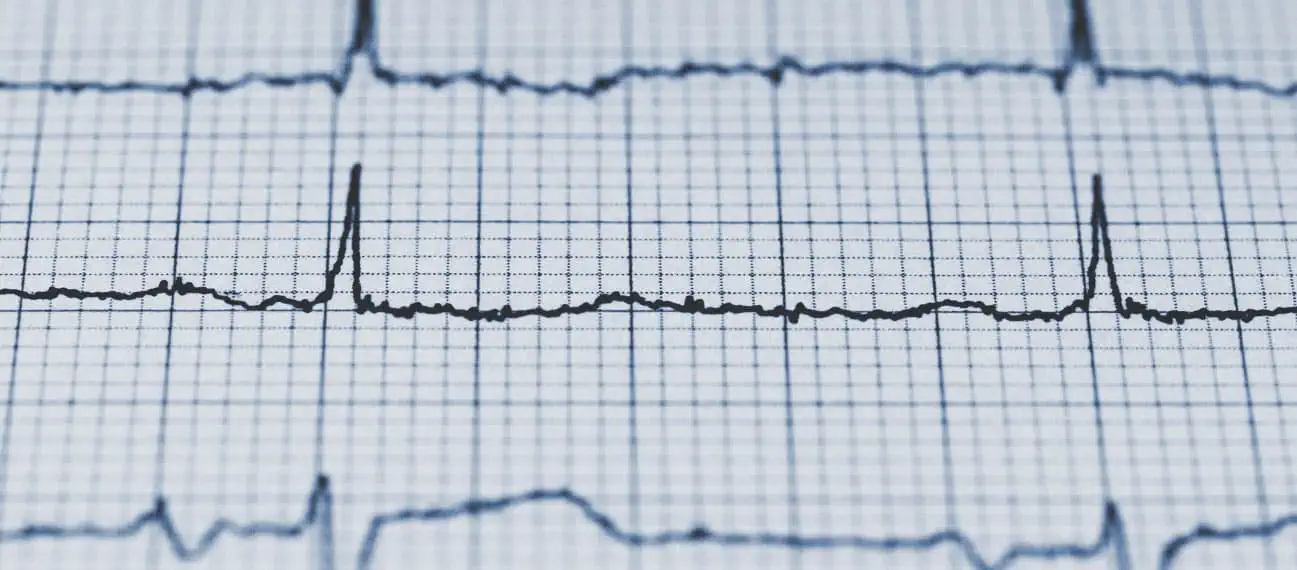 EKG health check